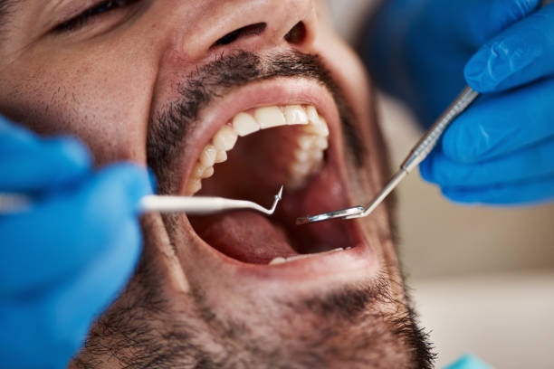 Best Emergency Tooth Extraction in Connellsville, PA